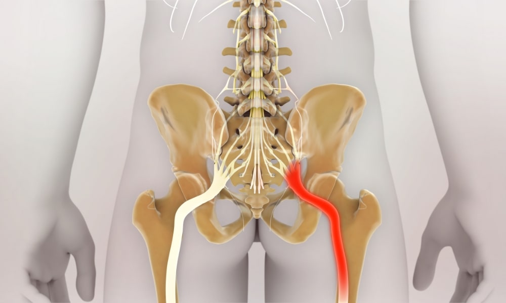 坐骨神経の太さ