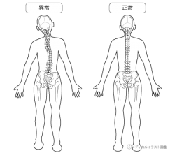 四十肩・五十肩の施術